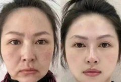 Foreign trade export OEM customized nutritional supplements: